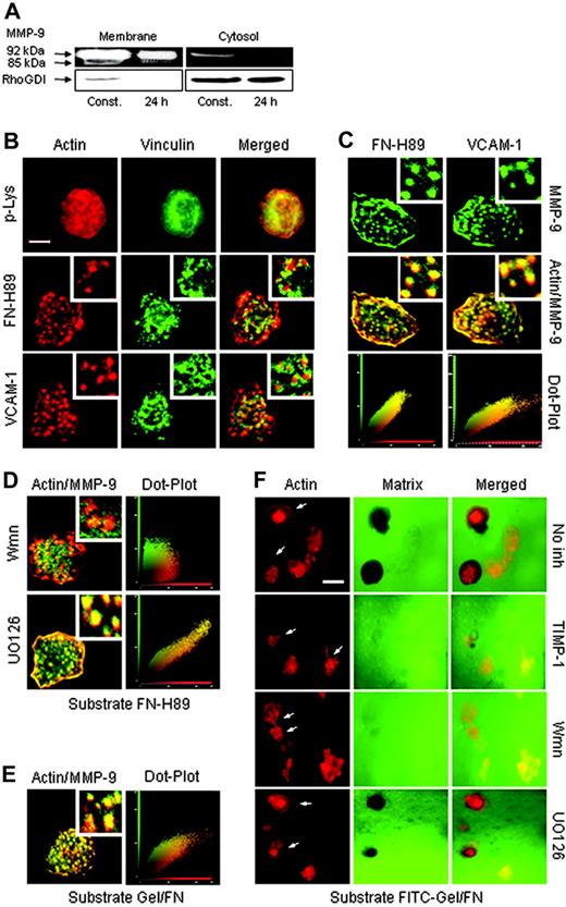 Figure 7. Analysis of cell-associated MMP-9 in B-CLL cells. (A) B-CLL cells (3 × 106) from a representative sample were incubated on FN-H89 for 24 hours. Cells were removed and membrane and cytosolic fractions separated and subjected to gelatin zymography. Identical aliquots from the same lysate were analyzed by Western blotting using anti-RhoGDI–specific Abs. (B) B-CLL cells in medium containing 80 nM PMA were added to glass coverslips coated with 5 μg/mL p-Lys, 10 μg/mL FN-H89, or 10 μg/mL VCAM-1. After 1 hour at 37°C, podosomes were analyzed by confocal microscopy after staining F-actin (red) with Alexa 568–phalloidin and vinculin (green) with specific primary Abs/FITC-labeled secondary Abs. Inserts are ×20 magnifications. Bar represents 4 μm. (C) B-CLL cells were added to FN-H89– or VCAM-coated glass coverslips, and after 1 hour MMP-9 (green) was visualized with specific primary Abs and Alexa 488–labeled secondary Abs. F-actin (red) was stained as explained in panel B, and the merged images are shown. Colocalization (yellow) of MMP-9 and F-actin in podosomes was further demonstrated using dot-plot analyses as explained in “Materials and methods.” (D) B-CLL cells were preincubated or not for 1 hour with 30 nM wortmannin (Wmn) or 10 μM UO126 and added to glass coverslips coated with 10 μg/mL FN-H89. F-actin and MMP-9 were visualized as explained, and the merged images (yellow) and dot-plot analyses are shown. (E) B-CLL cells were added to coverslips coated with gelatin/fibronectin; after 24 hours, colocalization of actin and MMP-9 in podosomes was analyzed as explained. (F) B-CLL cells, with or without the indicated inhibitors, were added to coverslips coated with FITC-gelatin/fibronectin; after 24 hours, F-actin was stained with Alexa 568–phalloidin and sites of matrix degradation were visualized by the loss of green fluorescence. Arrows indicate cells containing podosomes. Bar represents 12 μm. Images were acquired using a confocal scanning inverted AOBS/SP2 microscope (Leica Microsystems, Heidelberg, Germany) with a 63×/1.3 NA PL-APO glycerol immersion objective. Leica's LCS 15.37 dye-separation software was used for colocalization studies; when necessary, Adobe Photoshop 7.0 (Adobe Systems, San Jose, CA) was used for image processing.