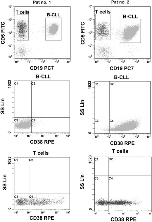 Figure 1. CD38-expression profiles of B-CLL cells (CD19+CD5+) and T cells (CD19–CD5+) as detected by 3-color flow cytometry. Fresh blood samples were incubated with a mixture of fluorescence-labeled anti-CD19, anti-CD5, and anti-CD38 mabs for 15 minutes followed by lysis of red blood cells with a FACS lysing solution. CD19+CD5+ cells (B-CLL) and CD19–CD5+ cells (T cells) were analyzed for CD38 expression. Representative results from a patient with CD38 low risk (< 30% CD38+ B-CLL cells, < 50% CD38+ T cells, left row) and CD38 high risk (≥ 30% CD38+ B-CLL cells, ≥ 50% CD38+ T cells, right row) are presented.