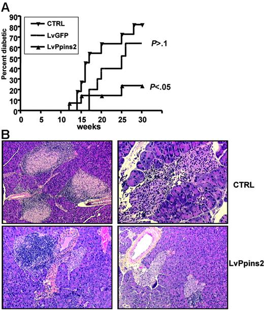 Figure 6. Prevention of diabetes and insulitis in NOD mice after intrathymic injection of a preproinsulin-2–expressing lentiviral vector. (A) Cumulative diabetes incidence (Kaplan-Meier survival curve) in unmanipulated mice (CTRL, n = 11) or after intrathymic injection of a GFP-expressing (LvGFP, n = 10) or preproinsulin-2–expressing (LvPpins2, n = 14) lentiviral vector. Indicated for LvGFP and LvPpins2 survival curves are the P values calculated with a log-rank test relative to the untreated NOD mice. (B) Sections of formalin-fixed pancreas from 10-week-old untreated nondiabetic mice (top left: original magnification, ×20), 36-week-old LvGFP-treated diabetic mice (top right: original magnification, ×100), and LvPpins-2–treated nondiabetic mice (bottom left and right: original magnification, ×20). Paraffinembedded sections of pancreas from NOD mice were stained with hematoxylin for 5 minutes followed by eosin for 30 seconds to reveal nucleated cells. Images were taken with either a 10×/0.3 PL or a 20×/0.5 FLUOTAR AB objective of a DM RB microscope (Leica Microsystems, Wetzlar, Germany). Image digitization was performed by a DXC930P CDD color video camera (Sony France, Clichy, France) with TRIBVN ICS software v. 1.2.0.9 (TRIBVN, Châtillon, France). Images were processed for contrast and luminosity using Adobe Photoshop CS.