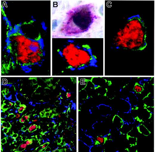 Figure 2. Characterization of mucosal FOXP3+ cells. Counterstaining of FOXP3 (red; detection with SA-Cy2 or SA-Cy3), CD3 (green; anti–Dig-Cy5) with surface markers of Tregs (blue; anti–goat Cy3) CTLA-4 (A), GITR(C), and CD25 (blue; anti–mouse Alexa 488) by immunofluorescence (B, bottom panel) or of FOXP3 (brown; immunoperoxide) with CD25 (red; APAAP) by immunohistochemistry (B, top panel) revealed clear coexpression. On the other hand, counterstaining of FOXP3 (red), CD3 (green), and T-lymphocyte activation markers (blue; anti–mouse Alexa488) HLA-DR (D) and CD38 (E) did not detect any cells positive for both markers. Depicted are representative sections from duodenal biopsies of HIV-infected patients. Original magnification ×600 (A-C) and ×400 (D-E). Microscope: Olympus AX70 (Olympus, Hamburg, Germany). Numerical aperture of objective lenses: ×40, 0.95 mm; ×60, 1.40. Camera: JVC KY-F70 (JVC, Yokohama, Japan). Acquisition software: DISKUS (Carl H. Hilgers, Königswinter, Germany). Software used for image processing: Adobe Photoshop 7.0 (Adobe, San Jose, CA).