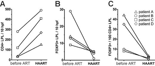 Figure 6. Longitudinal analysis of LPLs in 4 HIV-infected patients at the beginning (pre-ART) and during HAART. (A) CD4+ LPLs per 10 hpf, (B) FOXP3+ LPLs per 10 hpf, and (C) FOXP3+ T cells in percent of CD4+ LPLs. Clinical characteristics of the patients are provided in Table 2. Patient B (○) had already been treated by HAART at the first endoscopy for 8 weeks, while the other patients were initially treatment naive.