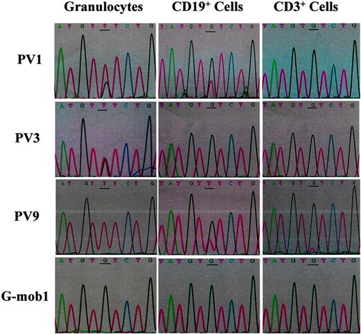 Figure 1. Sequencing of JAK2 PCR products from gDNAs (from 5 directions) of granulocytes, CD19+ and CD3+ cells purified from the PB of PV1, PV3, PV9, and a G-CSF–mobilized healthy volunteer. The mutational point is underlined. Mob indicates G-CSF–mobilized healthy donors.