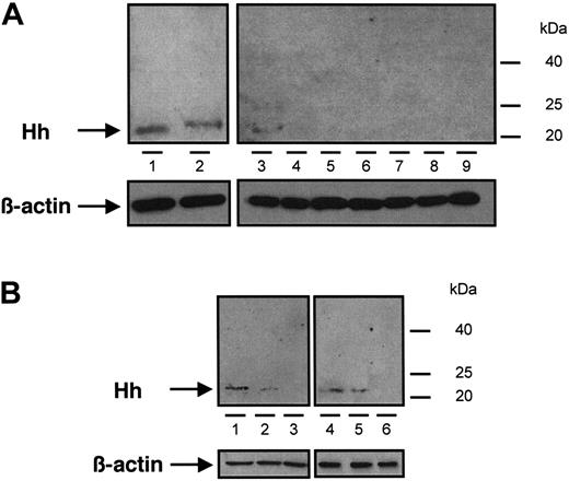 Figure 1. Immunoblot analysis of Hh content from different samples of MVs. (A) MVs generated from CEM T cells treated with PHA/PMA/act D (lanes 1 and 2, from 2 independent preparations), PHA/act D (lane 3), PMA (lanes 4 and 5, from 2 independent preparations), PHA (lanes 6 and 7, from 2 independent preparations), or act D (lanes 8 and 9, from 2 independent preparations). (B) MVs retrieved in vivo circulating in human peripheral blood (lanes 1 and 4) and MVs generated from lymphocytes treated with PHA/PMA/act D (lanes 2 and 5) or act D (lanes 3 and 6), from healthy (1-3) or diabetic individuals (4-6). Three determinations yielding similar results were performed. In panels A and B a β-actin control was included.