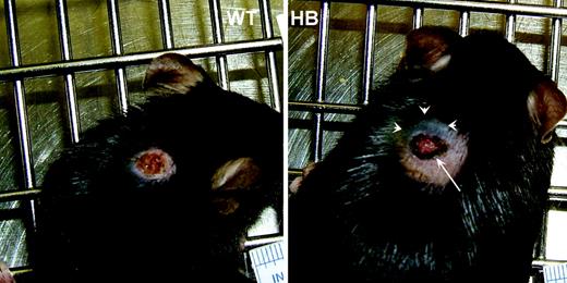 Figure 1. Gross appearance of 3-day-old punch biopsy wounds. Punch biopsy wounds were placed on the backs of wild-type (WT) and hemophilia B (HB) mice as described in “Materials and methods.” These representative photos show that both achieved hemostasis, but the wounds on HB mice tended to be larger and with dark coloration (arrow) due to red blood cells in the clot. The HB mice also developed subcutaneous hemorrhage with discoloration of the overlying skin (arrowheads).