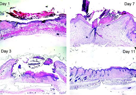 Figure 3. Histology of healing wounds in WT mice. Skin samples were fixed, processed, and stained as described in “Materials and methods.” Representative samples taken 1, 3, 7, and 11 days after wounding are shown. The original magnifications were × 40 (10 × ocular/4 × objective, NA = 0.13).