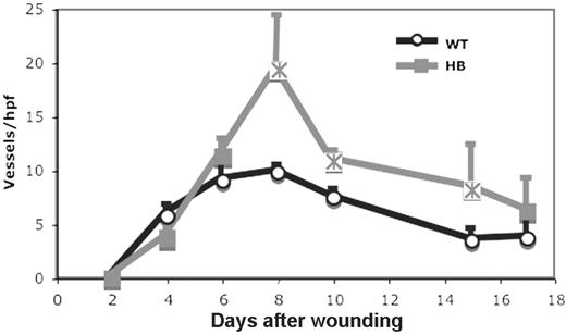 Figure 7. Angiogenesis in skin wounds in WT and HB mice. Angiogenesis was assessed by counting vessel profiles across the wound areas as described in “Materials and methods.” The counts are expressed per high-powered (× 40) field. The scores were averaged for 2 sections of 3 to 5 wounds at each time point. Points that are significantly different from WT (P < .05) are indicated by “×.”