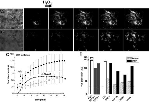 Figure 2. Effect of LPI on mitochondrial ROS production in primary cardiomyocytes. Primary cardiomyocytes were preincubated for 24 hours in medium with LPI-containing serum from an iron-overloaded patient (A) or with the same serum depleted of LPI by addition of equimolar DFO (B). The final LPI in panel B was less than 0.5 μM and in panel A 2.0 μM. After washing, the cells were loaded with 50 μM DHR for 10 minutes at 37°C and washed, and ROS production was monitored by epifluorescence microscopy and recorded at 2-minute intervals. The base line fluorescence was established, and 50 μM H2O2 was added at 4 minutes (indicated by arrow). The montage depicts snapshots of phase contrast images (A: serum with LPI, and B: serum depleted of LPI) and 5 (of 17) epifluorescence images of the same time sequence before and after H2O2 addition, taken at 2, 10, 18, 26, and 34 minutes. (C) Scatter plots of A and B showing average fluorescence density of 3 to 5 cells in each field indicating treatment with 30% LPI-containing human serum (curve A; • or 30% human serum depleted of LPI (curve B; ○. The line graph ΔLPI (▪) is the difference between curve B and curve A. (D) Relative ROS production levels in cardiomyocytes (determined with DHR and fluorescence microscopy) after incubation overnight with FAC (100 μM) in growth medium containing 10% fetal calf serum and 10% horse serum or in growth medium containing 30% human LPI-containing serum (□). The growth media were supplemented with the indicated concentrations (10, 20, or 100 μM) of chelators either present during the 24-hour preincubation (before, ▨) or added only 20 minutes before ROS determination (after, ▪). The dotted line represents the basal level of ROS production (27 au, arbitrary units of fluorescence) obtained by addition of excess iron chelator (200 μM DFR).