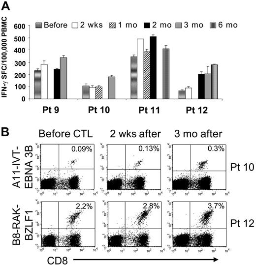 Figure 6. Immunologic evaluation of patients treated in the multiple-doses protocol. Four patients received multiple doses of 5 × 107/m2 EBV-CTLs. Panel A shows the frequency of EBV-specific T cells in the peripheral blood as measured by the number of IFN-γ–secreting PBMCs upon stimulation with irradiated autologous LCLs before and after CTL infusion. Bars represent the mean of triplicate wells ± SD. ELISPOT assay shows an increase in the frequency of circulating EBV-specific T cells after CTL infusion, persisting for longer than 2 months after infusion. Panel B shows the immunologic response of 2 patients with informative tetramers in the EBV-CTLs infused. The right panels show the frequency of tetramer-positive T cells on PBMCs collected before infusion. Left panels show that the frequency of the tetramer-positive T cells increased after CTL infusion.