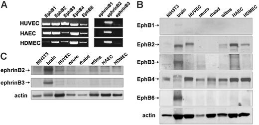 Figure 1. Expression of EphB receptors and ephrin B ligands in primary human endothelial cells from the umbilical vein, aorta, and dermal microvasculature. (A) EphB1, EphB2, EphB3, EphB4, and EphB6 receptor and ephrin B1, ephrin B2, and ephrin B3 ligand mRNA detected by semiquantitative RT-PCR with specific primer pairs in HUVECs, HAECs, and HDMECs. Representative results from 3 experiments. (B) EphB1, EphB2, EphB3, EphB4, and EphB6 were detected by Western blotting with specific antibodies in cell lysates from murine NIH3T3 cells, human brain tissue (brain), HUVEC, human SK-N-MC neuroblastoma cell line (neuro), human A-204 rhabdomyosarcoma cell line (rhabd), and human SK-NEP-1 Wilms tumor cell line (wilms), HAEC, and HDMEC. Results shown, which are representative of 4 independent immunoblotting experiments, reflect reprobing of a single membrane after stripping; sample loading was evaluated by reprobing for actin. (C) Immunoblotting analysis of ephrin B2 and ephrin B3 expression in HUVECs, HAECs, HDMECs, and other samples—murine NIH3T3 cells, human brain tissue (brain), human SK-N-MC neuroblastoma cell line (neuro), human A-204 rhabdomyosarcoma cell line (rhabd), and human SK-NEP-1 Wilms tumor cell line (wilms). A single membrane was used for immune detection; sample loading was evaluated by probing with antiactin antibodies. Results are representative of 3 immunoblotting experiments.