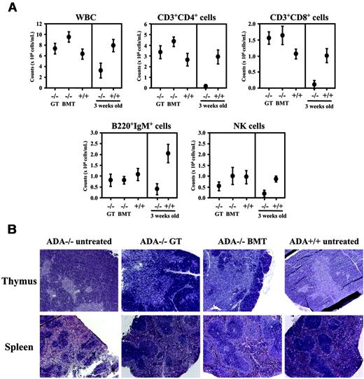 Figure 7. Lymphoid reconstitution after neonatal treatment. (A) Number of mature T and B cells in the peripheral circulation of GT (–/– GT) and transplant-recipient ADA–/– mice (–/– BMT) treated at neonatal age. As control, untreated age-matched ADA+/+ mice (+/+; n = 6) are reported. FACS analysis was used to determine the absolute number, represented as mean ± SD, of white blood cells, CD3+CD4+ and CD3+CD8+ T cells, B220+IgM+ B cells, and NK cells evaluated 5 months after GT (n = 5) or BMT (n = 8). Cell counts from untreated 18-day-old ADA–/– (–/–; n = 14) and ADA+/+ (+/+; n = 8) mice are shown on the right. (B) H&E stainings of thymus and spleen sections (× 5 magnification) in ADA–/– mice (untreated, treated with GT or BMT) and ADA+/+ mice. Tissues from ADA–/– untreated controls were collected postnatally at day 18, while all other mice were analyzed 6 months after treatment.