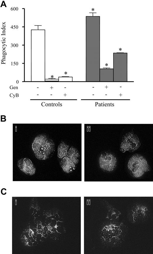 Figure 3. Effect of phagocytosis on actin polymerization and protein tyrosine phosphorylation in septic neutrophils. (A) Phagocytic index of neutrophils from controls (□) or patients with sepsis (▦), treated (+) or not (–) with CyB (15 μg/mL) or with genistein (Gen; 80 μM). Data are means ± SD. *P < .05 compared with controls (ANOVA followed by Bonferroni). Fluorescence microscopy (magnification: × 1000) for F-actin (B) and phoshotyrosine (C) of neutrophils from controls (i; □) and patients with sepsis (ii; ▦), after phagocytosis of opsonized zymosan, performed as described in “Patients, materials, and methods.”