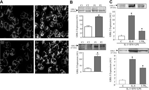 Figure 5. Increase of GRK2 and GRK5 expression in septic neutrophils. (A) Neutrophils from controls (i, iii) or patients with sepsis (ii, iv) were immunostained for GRK2 (i-ii) and GRK5 (iii-iv). The panels show a representative experiment out of at least 7 independent experiments. (B) Immunoblotting for GRK2 (top panel) and GRK5 (bottom panel) in neutrophils from patients with sepsis (▦) or healthy volunteers (□). The blots, obtained from 2 representative experiments, show GRK2 and GRK5 expression in neutrophils from controls (C1, C2) and patients with sepsis (P1, P2). (C) Immunoblotting for GRK2 (top) and GRK5 (bottom) in neutrophils from healthy volunteers incubated with cytokines and LPS, plus IL-8 (10–9 M) or LTB4 (10–8 M), as described in “Patients, materials, and methods.” For immunoblotting, the densitometry of each band, expressing the content of GRK2 and GRK5, was analyzed and expressed in arbitrary units (AU). Data show means ± SD of at least 6 experiments. *P < .05 compared with nontreated cells (ANOVA followed by Bonferroni).