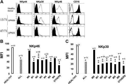 Figure 1. NCRdull phenotype is common and not dependent of AML subclass. NK cells from 71 patients were analyzed by flow cytometry at diagnosis. (A) AML-NK cells were gated on the CD45high CD3−CD56+ fraction of fresh PBMCs. Filled histograms represent isotype-matched mAb staining; open histograms represent staining with specific PE-conjugated mAbs. Represented are 1 healthy donor with NCRbright NK cells (top), 1 of 13 AML patients with NCRbright NK cells (middle), and 1 of 47 AML patients with NCRdull NK cells (bottom). (B) Mean fluorescence intensity (MFI) of surface staining with anti-NKp46 and anti-NKp30 PE-conjugated mAbs of NK cells from healthy donors (Healthy), from AML regardless the FAB subclass (All), and from distinct subclasses (FAB classifications M0-M6). Others are particular forms of AML (Table 1). *P<.001; **P ≤ .01; ***P < .05. n represents number of patients. M0 indicates AML minimally differentiated; M1, AML without maturation; M2, AML with maturation; M3, acute promyelocytic leukemia; M4, acute myelomonocytic leukemia; M5, acute monocytic leukemia; M6, acute erythroid leukemia.