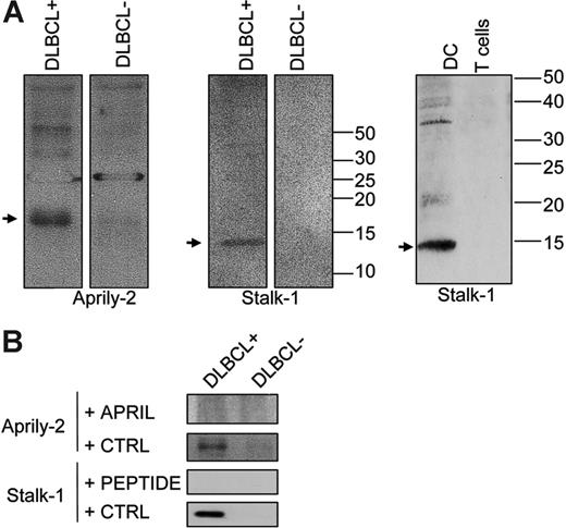 Figure 2. Characterization of anti-APRIL antibodies identifying secreted APRIL and cells producing APRIL. (A) Extracts (20 μg) from IHC-positive and -negative DLBCL tissue samples were analyzed by Western blot with Aprily-2 (2 μg/mL) and Stalk-1 (5 μg/mL). An 18-kDa band corresponding to secreted APRIL was revealed with Aprily-2 (left), whereas Stalk-1 identified a 14-kDa band (middle). Similar 14-kDa reactivity was observed with Stalk-1 on DC lysates (20 μg) (right). The reactivity is representative of 3 IHC-positive and 2 IHC-negative tumor lysates. (B) Western blot specificity was ascertained in blocking experiments. Aprily-2 was preincubated with 10 μg/mL acrpAPRIL or acrpCTRL. Stalk-1 was preincubated with 10 μg/mL stalk peptide or an irrelevant peptide prior to Western blot analysis.