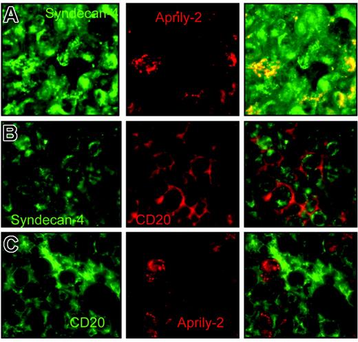 Figure 5. APRIL is concentrated on tumor cells by proteoglycans. (A) DLBCL lesions were stained with anti–syndecan-4 (green, 10 μg/mL) and Aprily-2 (red), (B) with anti–syndecan-4 (green) and anti-CD20 (red), and (C) with anti-CD20 (green) and Aprily-2 (red). Single stainings and the corresponding merge picture are representative of 4 patients.