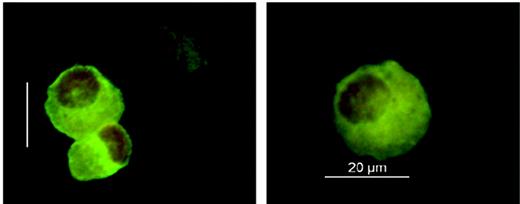 Figure 1. Immunofluorescence analysis of Langerhans cells. Langerhans cells were isolated from 6-mm-punch biopsies of uninvolved skin using magnetic CD1a beads. Cells were stained on cytospin preparations using an FITC-labeled CD1a antibody and cell nuclei counterstaining with 7-AAD (DMR microscope equipped with an HCX PL FLUOTAR 40 ×/0.75 non-oil objective lens, DFC-camera, and IM500 V4.0 software; Leica, Wetzlar, Germany).