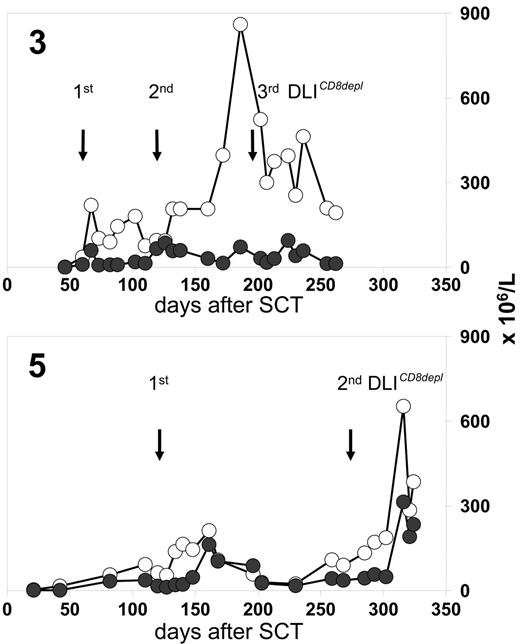 Figure 4. Rapid increase of circulating CD4 T cells after CD8-depleted DLIs. Flow cytometry analyses were performed on CD4 T cells (-○-) and CD8 T cells (-•-) within peripheral blood of representative patients 3 and 5 receiving CD8-depleted DLIs.