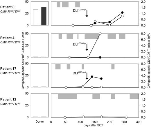 Figure 6. Expansion of CMV-specific CD4 and CD8 T cells after CD8-depleted DLIs. Before and after CD8-depleted DLIs, the frequencies of CMVpp65-specific T cells were determined within purified CD4 and CD8 blood lymphocytes of CMVpos patients 8, 4, 17, and 12 by IFN-γ ELISPOT assays. Numbers indicate CMVpp65-specific CD4 (-○-) and CD8 (-•-) T cells × 106/L. All donors were unrelated volunteers with full HLA match, and were either seropositive (patient 8) or seronegative (patients 4, 17, 12) for CMV. Donor PBMCs were also screened for CMVpp65-specific CD4 (□) and CD8 (▪) T cells in IFN-γ ELISPOT assays. Longitudinal bars (⊡) indicate duration of CMVpp65 antigenemia. R, recipient; D, donor.