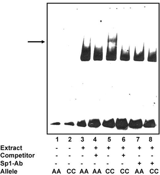 Figure 2. Genotype-dependent binding of nuclear proteins to the human BCL2 promoter. Electrophoretic mobility shift assays (EMSAs) were performed using nuclear extracts (10 μg) from human follicular lymphoma cells (Karpas 422). Nuclear extracts were incubated with DIG-labeled oligonucleotides. Assays were performed in the absence (−) or presence (+) of 100-fold molar excess of unlabeled oligonucleotide. Arrow indicates a specifically retarded band observed upon addition of nuclear extracts from Karpas cells. These extracts contain nuclear proteins that specifically bind to the construct with the BCL2−938C allele compared with the BCL2−938A allele. Moreover, addition of an Sp-1 antibody competed this band almost completely away, suggesting that this band was specific for Sp-1 binding sites.
