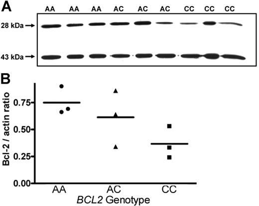 Figure 3. Genotype-dependent expression of Bcl-2 protein in B cells from CLL patients. (A) Western-blot analysis of B cells from patients with genotype BCL2−938AA showed increased expression of Bcl-2 protein (28 kDa) compared with those from patients with BCL2−938AC and BCL2−938CC genotypes. Actin (43 kDa) was used as a standard to allow for normalization to differential protein loading. (B) Quantitative analysis of protein expression shown in panel A. Densitometry was performed using Scion Image statistical analysis, as described in “Western-blot analysis.” Statistical analysis was performed using the linear ANOVA test. Horizontal bars represent the mean value of the three values of each genotype.
