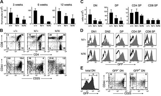 Figure 4. Lymphoma development in IgHP5ki mutant mice. (A) Kaplan-Meier survival curves. The survival of IgHP5ki/+ mice (n = 153) and IgHP5ki/P5ki mice (n = 46) was followed over time. Lymphomas were detected in all dead IgHP5ki/P5ki mice, which were subjected to macroscopic or histologic analysis. Because we were unable to analyze 36% of the IgHP5ki/P5ki mice at death, we conclude that at least 64% of all homozygous mutant mice died due to lymphoma development. (B-D) Gross aspect of the thymus (B), spleen (C), and lymph nodes (D) of the moribund IgHP5ki/P5ki (ki/ki) tumor mouse 11 and a wild-type (+/+) littermate. (E-G) Disrupted architecture of the thymus in the IgHP5ki/P5ki tumor mouse 11. Histologic sections of the thymus from a wild-type mouse (E) and the IgHP5ki/P5ki tumor mouse (F-G) were stained with eosin and hematoxylin. The cytologic details of the tumor cells are shown at higher magnification in panel G. CO indicates cortex; ME, medulla. (H-K) Infiltration of the lung (H), liver (I), and kidney (J) by lymphoma cells in the diseased IgHP5ki/P5ki tumor mouse 11.