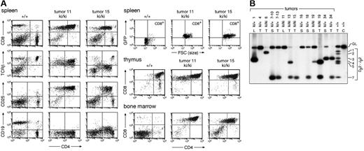 Figure 5. Ectopic Pax5 expression results in immature T-cell lymphomas. (A) Immunophenotype of lymphoma cells. The spleen, thymus, and bone marrow of a wild-type (+/+) and 2 IgHP5ki/P5ki (ki/ki) tumor mice were analyzed for CD4 and CD8 expression; TCRβ, CD19, CD25, and GFP expression is also shown for the splenocytes. (B) Clonal TCRβ rearrangements in Pax5-induced T-cell lymphomas. Dβ2-Jβ2 rearrangements were analyzed by PCR amplification of tumor DNA isolated from the thymus (T), lymph node (L), or spleen (S) of IgHP5ki/+ and IgHP5ki/P5ki mice. The different tumor mice are indicated by their numbers. The designations 7-10 and 7-13 refer to secondary lymphomas in the spleen of the recipient mice 10 and 13, which were intravenously injected with lymphoma cells from the spleen or thymus of tumor mouse 7, respectively. C indicates control tail DNA. Numbers to the right refer to the different Jβ2 segments and GL to the germline PCR product.