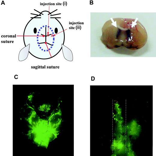 Figure 3. Mouse model of CNS Ph+ leukemia. (A) Diagram showing the injection sites. (B) Section from the brain of a mouse that had received trypan blue at the correct injection site. The white arrow indicates the trypan blue distributed in the bilateral cerebral ventricles. Brain (C) and spinal cord (D) taken from a mouse on day 16 after inoculation of 5 × 104 Ba/F3/wt bcr-ablGFP cells at the correct injection site. The dotted lines indicate the outline of the spinal cord. The data shown are representative of 3 independent experiments.