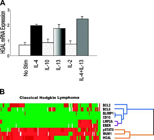 Figure 3. Cytokine signaling and pSTAT6 in classic Hodgkin lymphoma. (A) Enriched peripheral-blood lymphocytes stimulated with 100 U/mL IL-4, 50 ng/mL IL-10, 100 U/mL IL-2, 10 ng/mL IL-13, or a combination of IL-4 and IL-13 for 6 hours are shown. Only IL-4 and IL-13 induced HGAL mRNA expression, and the combination of IL-4 and IL-13 resulted in a slightly additive induction of HGAL mRNA expression. Error bars indicate SD among 3 experiments. (B) Hierarchic cluster analysis shows that pSTAT6 expression coclusters with HGAL and MUM1/IRF4 on the same branch of the dendrogram (orange), indicating a similar pattern of staining for these 3 proteins across the 145 cHL cases.