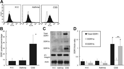 Figure 1. DDR1 expression of eosinophils. (A) Flow cytometry analysis of DDR1 expression on peripheral blood eosinophils from CSS patients, asthma patients, and healthy volunteers (H.V.). (B) Comparison of DDR1 expression level among CSS patients, asthma patients, and healthy volunteers (*P < .001, Bonferroni-Dunn test with 1-way factorial ANOVA). (C) Western blot analysis of total DDR1, DDR1a, and DDR1b in peripheral blood eosinophils from CSS patients, asthma patients, and healthy volunteers. (D) Comparison of total DDR1 and DDR1 isoform amount among CSS patients, asthma patients, and healthy volunteers (*P < .001 when compared with asthma patients and healthy volunteers; **P < .01, Bonferroni-Dunn test with 1-way factorial ANOVA). Error bars indicate standard deviation.