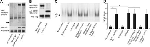 Figure 3. DDR1 activation and NF-κB activation in the eosinophils of CSS patients. (A) Western blot analysis for phospholyrated DDR1 and Shc by the stimulation with DDR1 agonistic antibody, control IgM, and collagen. (B) Western blot analysis for Flag fusion protein with or without collagen-binding site of DDR1. (C) Analysis of nuclear NF-κB translocation in the eosinophils of CSS patients by the stimulation with DDR1 agonistic antibody, control IgM, and collagen in the presence or absence of β1 integrin–neutralizing antibody, DDR1-blocking protein, and control protein. (D) Comparison of NF-κB density (*P < .001, Bonferroni-Dunn test with 1-way factorial ANOVA). Error bars indicate standard deviation.