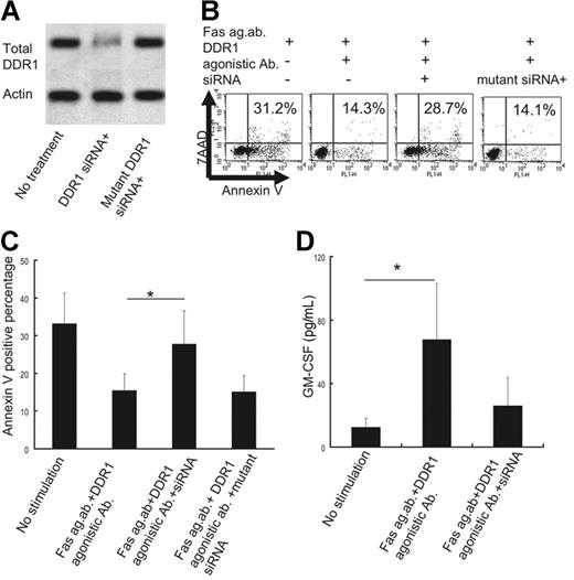 Figure 6. Effect of DDR1 suppression by siRNA. (A) Western blot analysis for DDR1 and actin in the presence or absence of DDR1 siRNA or mutated DDR1 siRNA. (B) Flow cytometry analysis of apoptotic cells in the presence or absence of DDR1 siRNA or mutated DDR1 siRNA. The x-axis indicates annexin V–positive cells, and the y-axis indicates 7AAD-positive cells. (C) Comparison of annexin V–positive cells in the presence or absence of DDR1 siRNA or mutated DDR1 siRNA *P < .01 as compared with no stimulation, Bonferroni-Dunn test with 1-way factorial ANOVA). (D) Comparison of GM-CSF production from eosinophils of CSS patients in the presence or absence of DDR1 siRNA (**P < .01 as compared with no stimulation, Bonferroni-Dunn test with 1-way factorial ANOVA). Error bars indicate standard deviation.