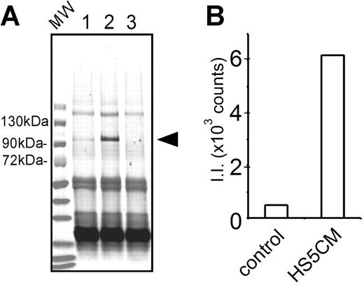 Figure 2. Secretion of MMP-9 protein. (A) CD14+ cells (0.1 × 106 cells) were cultured for 5 days in control medium or conditioned medium from HS-5 (lanes 1 or 2, respectively). Culture media were harvested. The media were immunoprecipitated, proteins were denatured, run on SDS-PAGE, and transferred onto a nitrocellulose membrane. The membrane was incubated with polyclonal anti–MMP-9 antibodies, followed by fluorescent-labeled secondary antibodies. As a control, fresh medium was used as a mock immunoprecipitation (lane 3). The conditioned medium from HS-5 cells was also negative (data not shown). An arrowhead indicates the position of MMP-9 protein. Immunoglobulin heavy and light chains (∼60 kDa and ∼25 kDa) are stained in all 3 lanes. This is a representative blot of 3 similar experiments. MW indicates a lane for prestained molecular weight markers. (B) Fluorescence intensity of MMP-9 protein bands in lanes 1 and 2 was determined by Odyssey scanner (Control and HS5CM, respectively). II indicates integrated intensity.