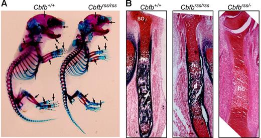 Figure 2. Bone defects in Cbfbrss/rss and Cbfbrss/− fetuses. (A) Alcian blue– and alizarin red–stained skeletal preparations from postnatal day 0.5 Cbfb+/+ and Cbfbrss/rss fetuses. Cartilaginous skeleton is blue and ossified bone is pink. Areas of skeletal abnormalities are indicated with arrows. (B) Tibias from 17.5-dpc Cbfb+/+, Cbfbrss/rss, and Cbfbrss/− fetuses stained for cartilage with safranin O (red) and for osteoblasts and hypertrophic chondrocytes by virtue of their alkaline phosphatase activity (blue). hc indicates hypertrophic chondrocytes; d, diaphysis; and so, secondary ossification center.