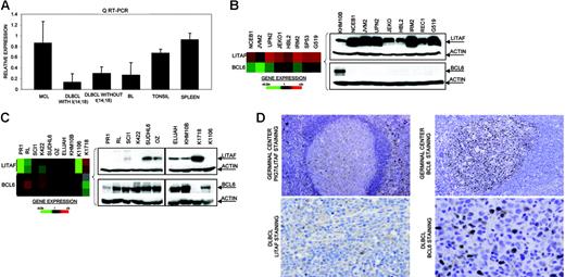 Figure 1. Identification of homozygous deletion and expression of PIG7/LITAF. (A) Real-time RT-PCR analysis of PIG7/LITAF expression in samples from tonsil and spleen and in B-NHL cell lines (10 MCL cell lines; 11 diffuse large B-cell lymphoma cell lines with t14:18), 3 diffuse large B-cell lymphoma cell lines lacking t(14;18), and 6 Burkitt lymphoma cell lines. Data shown are the relative gene-expression levels normalized with GAPDH bars indicate standard deviations. The results are derived from 3 independent experiments. DLBCL indicates diffuse large B-cell lymphoma; BL, Burkitt lymphoma. (B) Affymetrix oligonucleotide microarrays and Western blot analyses of PIG7/LITAF and BCL6 in MCL cell lines. KHM10B cell line was used as a positive control for BCL6 expression. (C) Lymphochip cDNA microarrays and Western blot analyses of PIG7/LITAF and BCL6 in B-NHL cell lines of different origins. (D) Immunohistochemistry analysis for PIG7/LITAF and BCL6 protein on tissue microarrays. In nontumoral tissue samples (tonsils), PIG7/LITAF expression was cytoplasmatic and was shown to be expressed mostly in mantle, marginal, and interfollicular lymphocytes, whereas BCL6 was shown to be expressed in germinal center B cells.