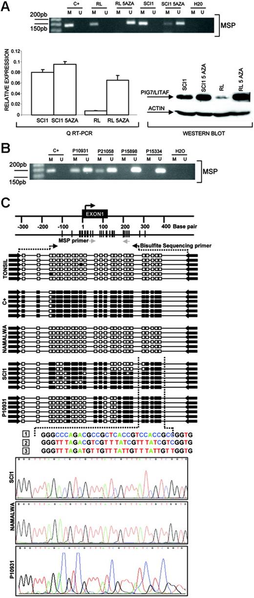 Figure 2. Promoter methylation of PIG7/LITAF. (A) Methylation-specific PCR (MSP), quantitative RT-PC, and Western blot analysis of PIG7/LITAF in RL and SCI-1 cell lines before and after treatment with 4 μM 5-Aza-2′-deoxycitine. The treatment with demethylating Aza restored PIG7/LITAF expression at the RNA and protein levels. In the QRT-PCR data analysis, gene-expression levels were normalized with GAPDH as an internal control; bars indicate standard deviations. C+ indicates methylated control. (B) Methylation-specific PCR (MSP) in 4 primary biopsies from patients with Burkitt lymphoma. M indicates methylated; U, unmethylated; C+, methylated control. (C) Sequence analysis of the PIG7/LITAF promoter region after bisulfite modification. The black box indicates the methylated cytosine, and the white box indicates the unmethylated cytosine in the dinucleotide CpG. Samples analyzed were a positive methylated control (C+); cells from a nontumoral tonsil (unmethylated); Namalwa (unmethylated); SCI-1 (unmethylated); and a lymph-node biopsy from a patient with Burkitt lymphoma (P10931) showing methylation. The numbers correspond to (1) genomic sequence of PIG7/LITAF promoter region, (2) methylated sequence of the PIG7/LITAF promoter region after bisulfite modification, and (3) unmethylated sequence of the PIG7/LITAF promoter region after bisulfite modification.