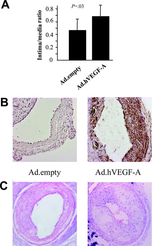Figure 1. Plaque-size analysis of cross-sections of carotid artery specimens obtained from Ad.empty- and Ad.hVEGF-A–treated ApoE−/− mice. Error bars represent standard deviation (n = 10-12). (A) Plaque sizes of Ad.hVEGF-A–treated compared with that of Ad.empty control mice are significantly increased by 49% (P = .03). (B) Ad.hVEGF-A–treated plaques (right panel) showed higher expression of the transgene at 10 days after transduction than Ad.empty-treated plaques. Please note that expression is largely confined to the intima and diffuse with a higher density in the cap region. (C) Hematoxylin/eosin staining of a typical Ad.empty– and Ad.hVEGF-A–treated atherosclerotic plaque. Error bars indicate standard deviation (SD).