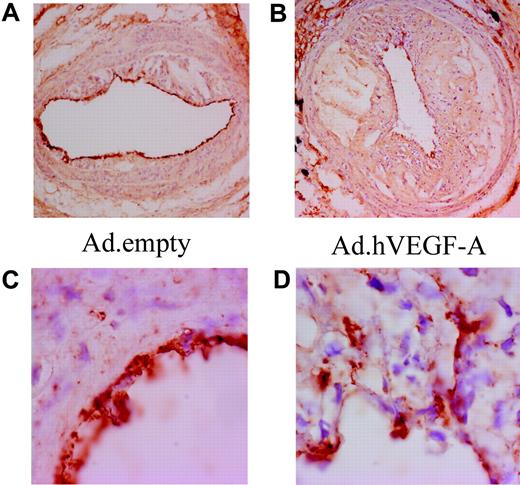 Figure 2. Ad.hVEGF-A treatment results in clear irregularities in endothelial morphology and arrangement. CD31 staining in Ad.empty–treated (A,C) and Ad.hVEGF-A–treated (B,D) plaques shows weakly stained microcapillaries in advanced carotid artery lesions. VEGF-A does induce endothelial cell sprouting from the lumen to the central atheroma in Ad.hVEGF-A–treated plaques (D); these endothelial irregularities are not observed in Ad.empty–treated plaques. Panels C and D are high-power views of the vessel segments shown in panels A and B, respectively. Original magnification: panels A and B, ×40; panels C and D, ×100.