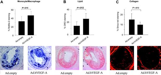Figure 3. Immunohistochemical analysis of Ad.hVEGF-A– and Ad.empty-transduced plaques on plaque composition and stability. The content was calculated as percentage of stained area relative to the total plaque size. (A) In Ad.hVEGF-A–treated plaques, MoMa2 staining, and thus macrophage content, was markedly increased by 40% (P = .014). (B) Analysis of Oil Red O–stained sections reveals a 66% increase in lipid content in Ad.hVEGF-A–treated plaques (P = .012). (C) Picro-sirius red–stained sections from Ad.empty controls and Ad.hVEGF-A–treated plaques. VEGF-A overexpression led to a significant decrease of 33% in plaque collagen content (P = .013). Error bars indicate SD.