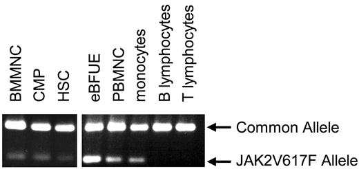 Figure 1. JAK2V617F detection in progenitor and mature cell subtypes. An allele-specific PCR technique1 was used to detect the JAK2V617F allele in eBFUE, PBMNC, monocytes (CD14+), HSCs (CD34+, CD38−, lin−), and CMP (CD34+, CD38+, lin−) from a JAK2V617F-positive polycythemia vera patient. The mutant allele was not detectable in the T lymphocyte (CD4/8+) or B lymphocyte (CD20+) fractions.