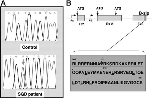 Figure 1. DNA sequence analysis of the C/EBPϵ gene in the SGD patient. (A) Genomic DNA isolated from a healthy individual (top panel, control) and from the SGD patient (bottom panel) was PCR amplified and sequenced using oligomers designed to capture the C/EBPϵ exons and intron-exon boundaries. The red arrow in the bottom panel indicates the heterozygous mutation in the SGD patient. (B) The genomic organization of the C/EBPϵ locus is indicated showing 3 exons (Ex 1, 2, and 3), 2 promoters (Pα and Pβ), 3 alternate translational start sites (ATG), and the highly conserved basic leucine zipper region (B-zip). (C) Amino acid sequence of the C/EBPϵ B-zip region. The heterozygous valine to alanine substitution in the SGD patient is indicated at position 218 in the basic region, which is underlined. The relevant leucine moieties are also underlined.