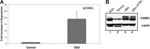 Figure 3. Expression of C/EBPϵ in the SGD patient. (A) Real-time PCR analysis of C/EBPϵ expression in a normal sample and in the SGD patient was carried out in triplicate. Transcript levels were normalized to that of β-actin and expressed as a ratio of the signal observed in the normal sample (1). Error bars indicate standard error of the mean (SEM). (B) Western blot analysis of normal and SGD PMNs. NB4 and NB4 cells treated with ATRA serve as an additional control for C/EBPϵ expression.