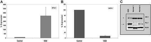 Figure 4. Expression of PU.1 and Gfi-1 in the SGD patient. Real-time PCR analysis of (A) PU.1 and (B) Gfi-1 expression in normal versus SGD PMNs. Transcript levels of each mRNA were assessed in triplicate and normalized to that of β-actin and expressed as a percentage of the signal observed in the normal sample (100%). Due to the paucity of RNA, this experiment was performed only once in triplicate. Error bars indicate SEM. (C) Western blot analysis of PMNs from SGD and normal samples. Nuclear extracts prepared from peripheral blood neutrophils (PMNs) of 2 healthy volunteers and our SGD patient were subjected to Western blot analysis. Equal concentrations of protein were loaded in each lane. The blot was sequentially probed with antibodies for Gfi-1, PU.1, and β-actin.