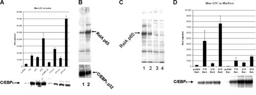 Figure 3. Mutation of Thr75 within the p38 MAP kinase site of C/EBPϵ affects C/EBP-ϵ–specific transactivation of a myeloid-specific promoter in the presence of activated NFkappaB. (A) The C/EBP-ϵ expression constructs for the wild-type (T75) or mutant (A75 and D75) proteins were transfected into Jurkat cells along with Mim promoter in a luciferase reporter vector. Half of the transfected cells were activated by addition of TPA and calcium ionophore. Cells were harvested 48 hours after transfection and luciferase (LUC) activity was analyzed using dual luciferase assay kit (Promega). Cotransfected renilla-luciferase expression plasmid was used as internal control for transfection efficiency. Results are presented in relative luciferase units (RLUs) as a mean of 3 independent experiments (▪), adjusted for transfection efficiency, with standard deviation (brackets). (B) Western-blot analysis of nuclear accumulation of p65RelA prior to (lane1) and after Jurkat cell activation with TPA and calcium ionophore (lane 2). (C) Level of C/EBP-ϵ transcriptional activation is dependent on the presence of p65RelA. Western-blot analysis of nuclear expression of p65RelA in parental MiaPaca2 cells (lane1) and after lentiviral vector–driven siRNA knock down of p65RelA expression in 3 different clones. Clones with maximal suppression of RelA expression, analyzed in lanes 3 and 4, were used for reporter assay experiments. (D) The C/EBP-ϵ expression constructs for either the wild-type (T75) or mutant (A75 and D75) proteins were transfected into MiaPaca cells that express high levels of nuclear RelA (Rel+) or the MiaPaca cells in which RelA expression was suppressed by specific siRNA (Rel-). C/EBP-dependent myeloid Mim luciferase reporter was cotransfected with either expression plasmids or control vector (pcDNA3.1). Each experimental point was done in triplicate and error bars represent standard deviation (SD).