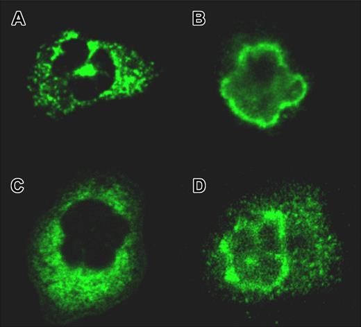 Figure 1. ANCA patterns as identified by confocal microscopy. (A) Classical ANCA (patient 1: diagnosis, Wegener granulomatosis; IIF, cANCA-IgG 1:1024; ELISA, anti-PR3 positive). (B) Perinuclear ANCA (patient 2: diagnosis, microscopic polyangiitis; IIF, pANCA-IgG 1:256; ELISA, anti-MPO positive). (C) Atypical cANCA contained in an intravenous immunoglobulin preparation (preparation E1, IgG titer 1:256). (D) Atypical ANCA (preparation A1, IgG titer 1:1024). A Leica TCS NT confocal light microscope with a 63×/1.32 NA oil PL APO 1.32-0.6 lens was used.