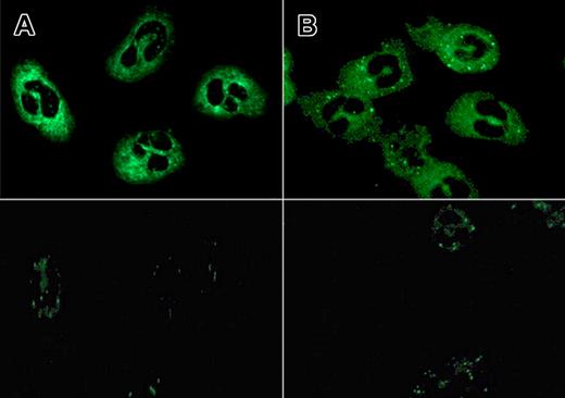 Figure 2. ANCA patterns found with IVIg and IVIg-F(ab′)2 fragments using equimolar concentrations. Flat atypical cANCA pattern identified with IVIg (21 mg/mL; batch A4; titer 1:128; panel A) and IVIg-F(ab′)2 fragments (14 mg/mL; prepared from batch A4; titer 1:128; panel B) as primary antibody, respectively, and FITC-conjugated goat anti–human anti-F(ab′)2 as secondary antibody (top panel) and corresponding negative controls (pooled serum of healthy donors, n = 5; diluted 1:8, bottom panel). A Leica DM RXE conventional fluorescence microscope with a 40×/0.75 PL APO ∞ −0, 17 lens was used.