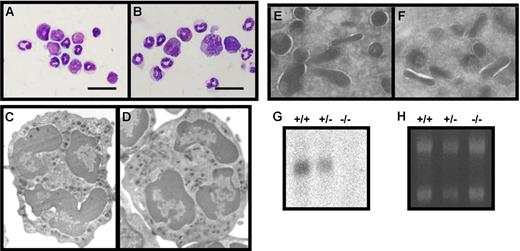Figure 1. Characterization of bone marrow cells from wild-type (+/+), heterozygous (+/−), and serglycin knockout (−/−) mice. (A-B) Giemsa staining of bone marrow cells from wild-type (A) and serglycin−/− mice (B). Murine neutrophils are characterized by donut-shaped nuclei with increasing lobulation during final maturation; bar, 20 μm. (C-D) Ultrastructure by electron microscopy of neutrophils from wild-type (C) and serglycin−/− mice (D). Higher magnifications of areas with granules from wild-type (E) and serglycin−/− neutrophils (F) show the same electron density of granules from the 2 genotypes. (G) Northern blotting with full-length serglycin probe. (H) Ethidium bromide staining of the gel before blotting, for control of equal loading; 5 μg total RNA from bone marrow cells per lane.