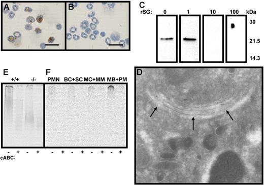Figure 2. Immunostaining for serglycin in bone marrow cells from wild-type and serglycin knockout mice and detection of 35S-labeled macromolecules. (A-B) Immunocytochemistry for serglycin; bar, 20 μm; neutrophils and precursor cells from wild-type mouse (A) and serglycin knockout mouse (B). (C) Western blotting of 1 ng recombinant murine serglycin per lane; detection with rabbit anti–murine serglycin IgG, blocked with 0 to 100 ng/mL murine serglycin as indicated above each lane. As seen, the immunoreactivity of the antibody is blocked in a dose-dependent manner by addition of the antigen in solution to the antibody. (D) Immunoelectron microscopy showing serglycin immunoreactivity (10 nm gold particles) in a myeloid cell from wild-type bone marrow; Golgi stacks are indicated by arrows. (E-F) Biosynthesis of 35S-labeled macromolecules in bone marrow cells and SDS-PAGE of cell lysates with (+) or without (−) cABC treatment. (E) Murine bone marrow cells from wild-type (+/+) and serglycin knockout mice (−/−). (F) Myeloid cells from human bone marrow and peripheral blood separated according to maturational stage; the designation of cell populations indicates the major cell types in each group (PMN, peripheral blood neutrophils; BC+SC, band cells and segmented neutrophils; MC+MM, myelocytes and metamyelocytes; MB+PM, myeloblasts and promyelocytes).
