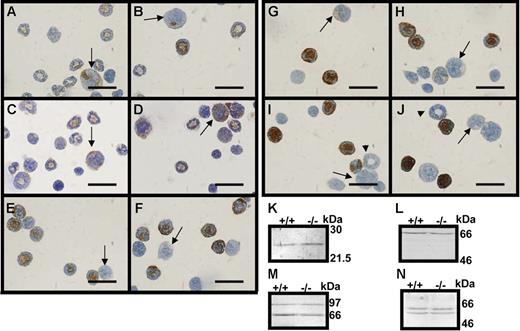 Figure 4. Immunocytochemistry and Western blotting for granule proteins. (A-J) Immunocytochemistry for neutrophil granule proteins; bar, 20 μm; arrows point toward promyelocytes and arrowheads toward myelocytes. (A,C,E,G,I) Bone marrow cells from wild-type mice. (B,D,F,H,J) Bone marrow cells from serglycin knockout mice. (A-B) MPO and (C-D) BPI protein, azurophil granule proteins, (E-F) 24p3 and (G-H) lactoferrin (specific granule proteins), and (I-J) gelatinase B (MMP-9) (gelatinase granule protein). (K-N) Western blotting for 24p3 (K), lactoferrin (L), MMP-9 (M), and MPO (N), lysates of bone marrow cells from wild-type (+/+) and serglycin knockout mice (−/−); molecular weight markers are indicated.