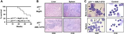 Figure 2. AML1-ETO promotes leukemia in p21Waf1-deficient mice. (A) Kaplan-Meier survival plot of mice receiving transplants of MigR1- or Mig-A/E–infected p21Waf1 cells. Mice were monitored for leukemia development 3 weeks after transplantation. (B) Hematoxylin and eosin staining of liver and spleen of a control mouse and a leukemic mouse, showing the disruption of the tissue architecture by infiltrating leukemic cells. (C) Accumulation of blast cells derived from AML1-ETO–expressing p21Waf1-deficient cells in hematopoietic compartments. Cells isolated from spleen and bone marrow from a recipient mouse of transplanted p21WAF1-deficient cells expressing AML1-ETO and a control were cytospun and stained with Wright-Giemsa for the analysis of immature blasts indicated by the arrows. Microscopy was performed with a Leica DMLB microscope (Leica Microsystems, Wetzlar, Germany) using an HC PLAN 10×/22 eyepiece and 10×/0.25 or 20×/0.4 objective lenses, or a 100×/1.30 oil-immersion objective lens (Richard Allan Scientific, Kalamazoo, MI). Pictures were captured using Spot software from Diagnostic Instruments (Sterling Heights, MI).