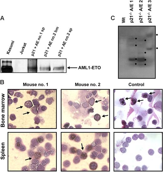Figure 3. Expression of AML1-ETO, MPO, and clonality in leukemic cells. (A) Western blot analysis of 2 independent mice spleen cell samples and one bone marrow cell sample showing the expression of AML1-ETO. Kasumi cells serve as a positive control. (B) Bone marrow and spleen cells from recipient mice of p21Waf1-deficient cells expressing AML1-ETO and a control mouse were cytospun and stained for MPO and counterstained with Wright-Giemsa for the analysis of immature blasts. The arrows indicate MPO+ immature blasts in the leukemic mice and in the control sample MPO+ neutrophils in the bone marrow. Image acquisition was performed as described for Figure 2, using a 100×/1.30 oil-immersion objective lens. (C) gDNA was isolated from 3 leukemic p21Waf1−/− mice expressing AML1-ETO. The DNA was digested with BamHI and a Southern blot prepared. The blot was hybridized with the ETO probe 5′ of the BamHI site in ETO, washed, and exposed to film. The black dots indicate the integration signals.